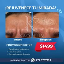 Promoción glúteos Kaoderm