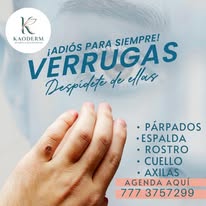 Promoción botox rostro
